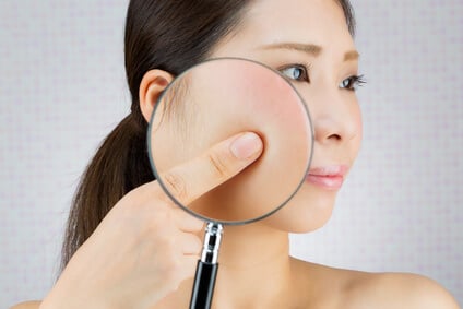 酵素洗顔によって解消される悩みについて考える女性