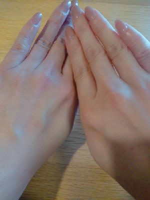 ナールスロゼを塗った手（左）と塗っていない手（右）の比較