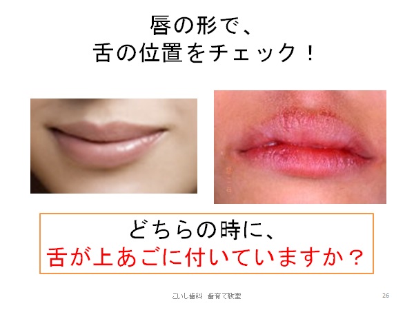 舌の位置による唇の形の違いを示す写真