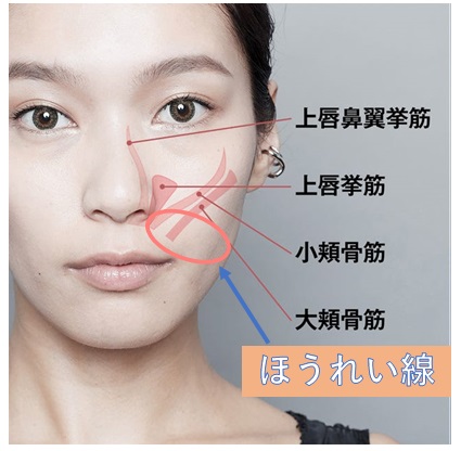 顔の表情筋とほうれい線の関係を示す写真